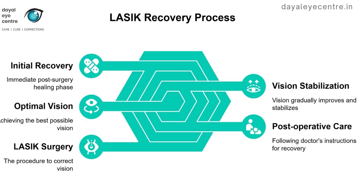 Lasik recovery process