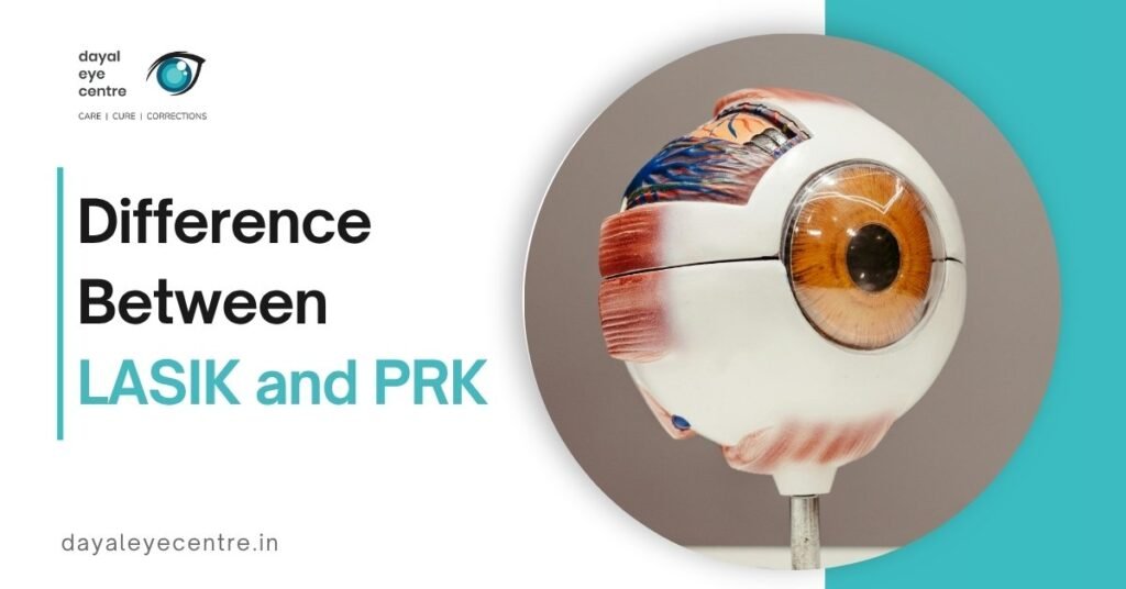 LASIK vs. PRK: Key Differences, Benefits & Which One to Choose