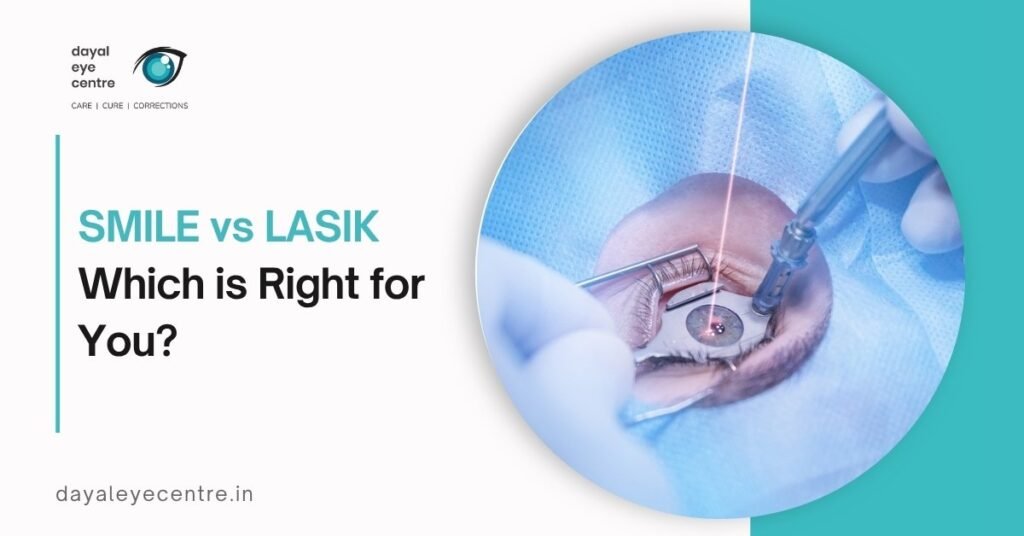 SMILE vs. LASIK: Which Vision Correction Surgery Is Best for You?