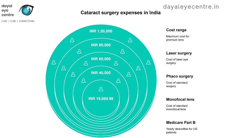 cataract surgery expenses in India