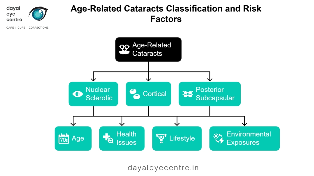 Age-related cataracts classification and risk factors