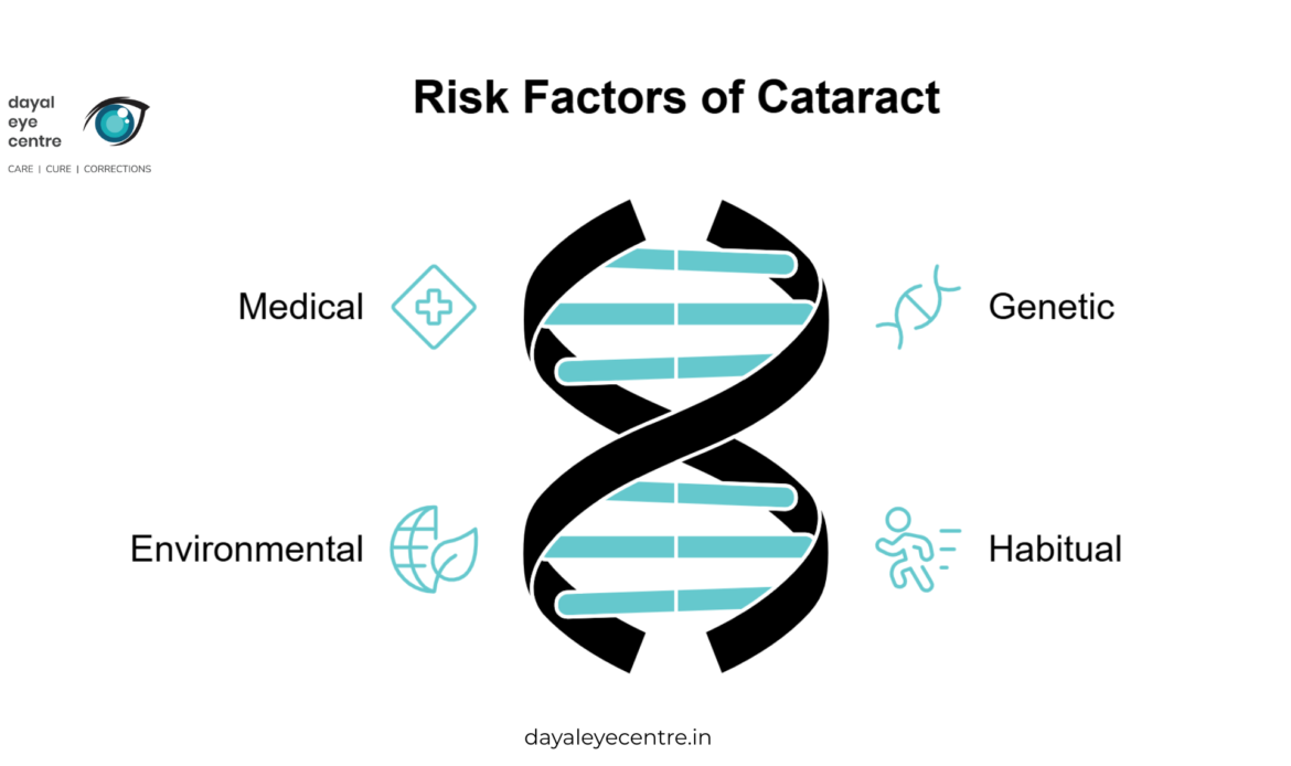 Risk Factors for Cataracts
