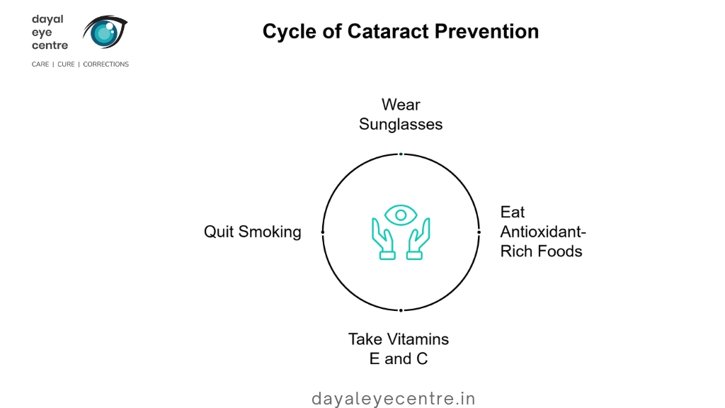 Cycle of cataract prevention