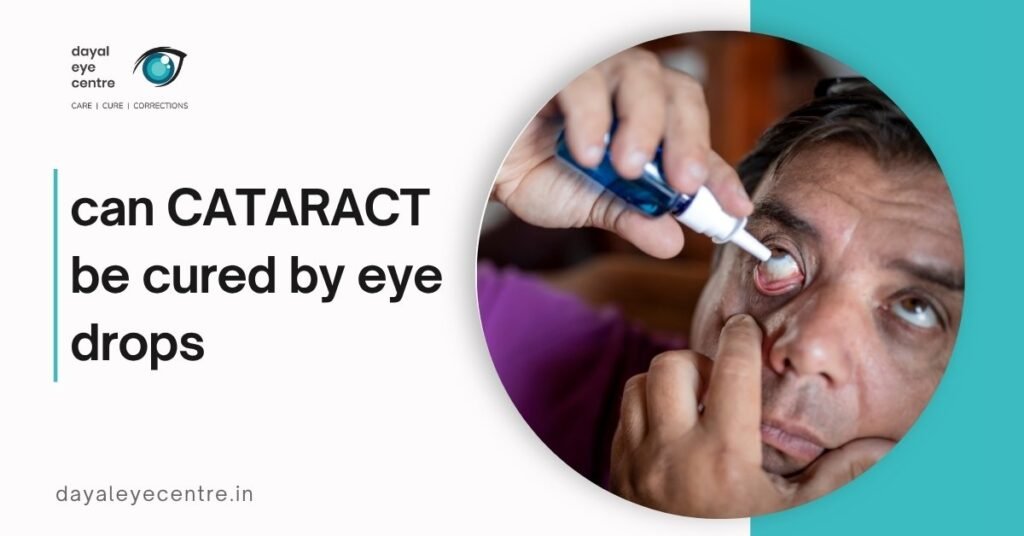 Can Cataract Be Cured by Eye Drops? Myths & Facts Explained