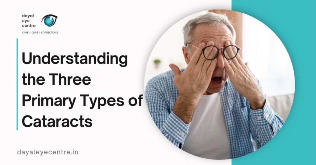 What Are the 3 Types of Cataracts? Causes & Differences Explained