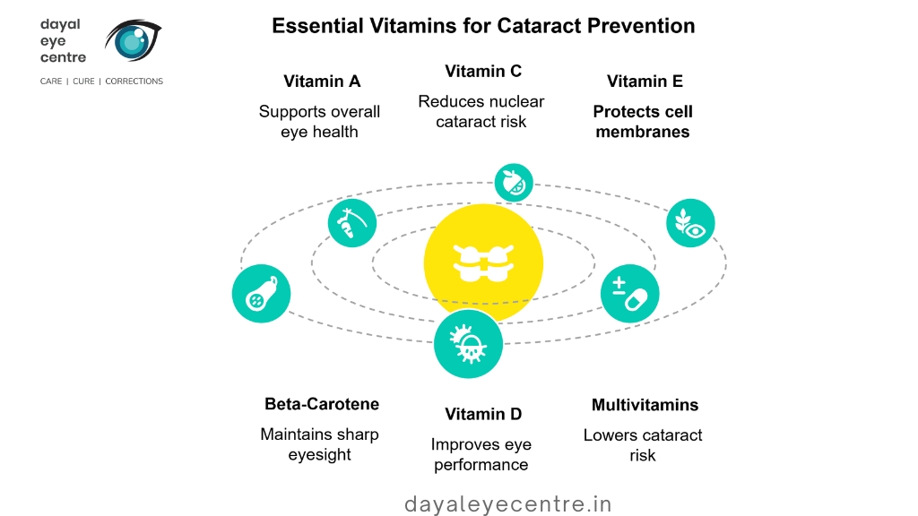 Essential vitamins for cataract prevention