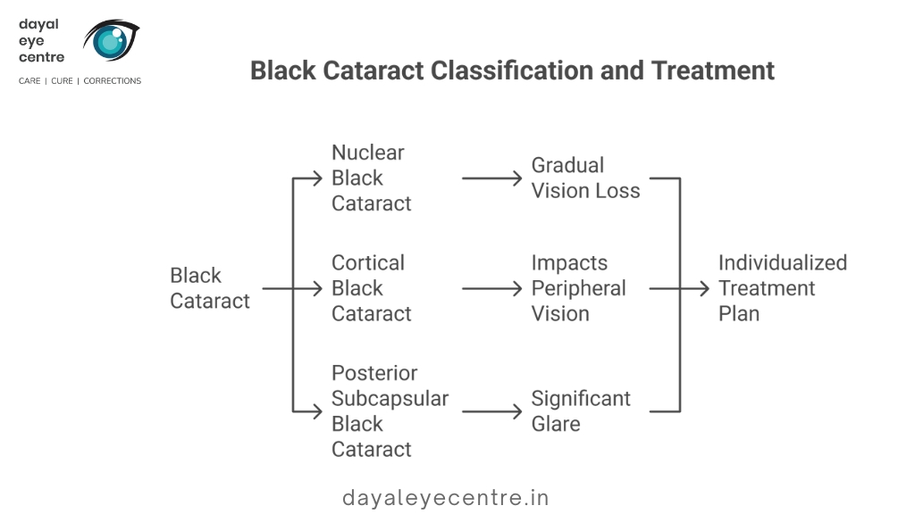 black cataract classification and treatment
