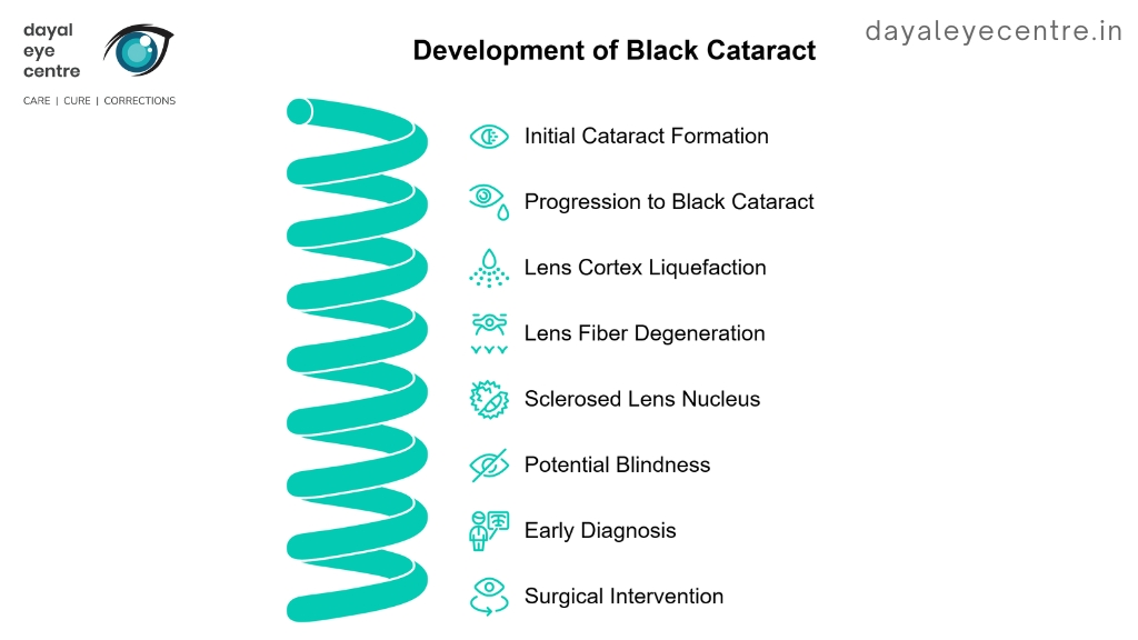 development of black cataract