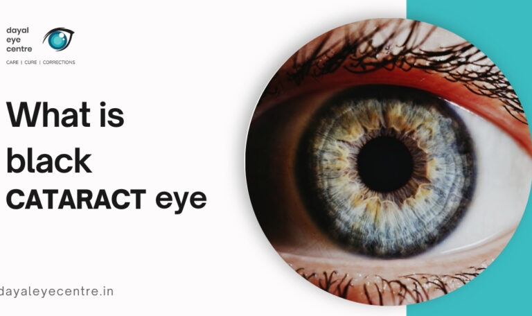 What is black cataract