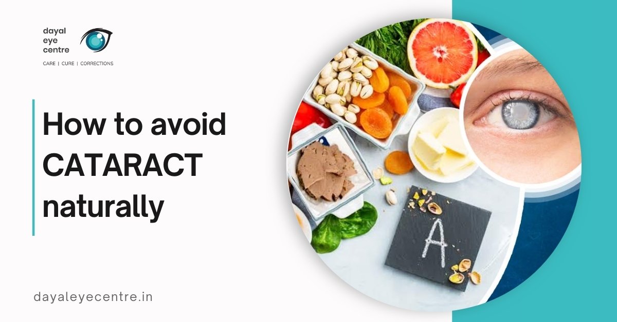 how to avoid cataracts naturally