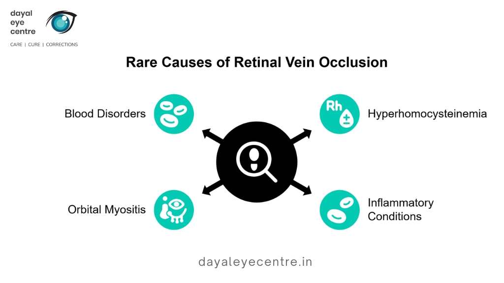Rare causses of retinal vein occlusion