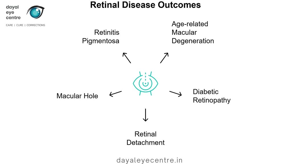 Retinal disease outcomes