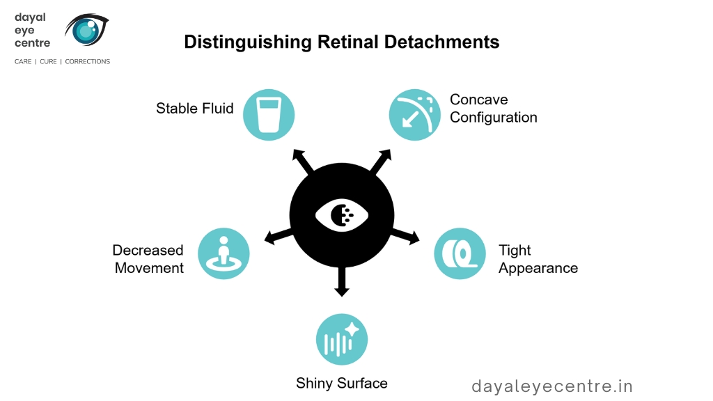 Distinguishing retinal detachment
