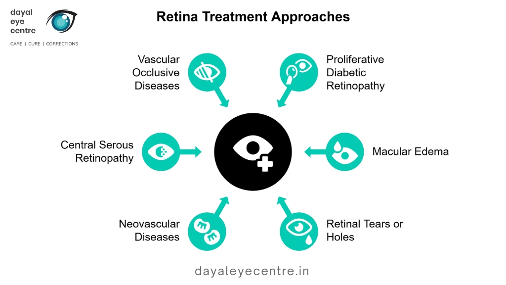 retina treatment approaches