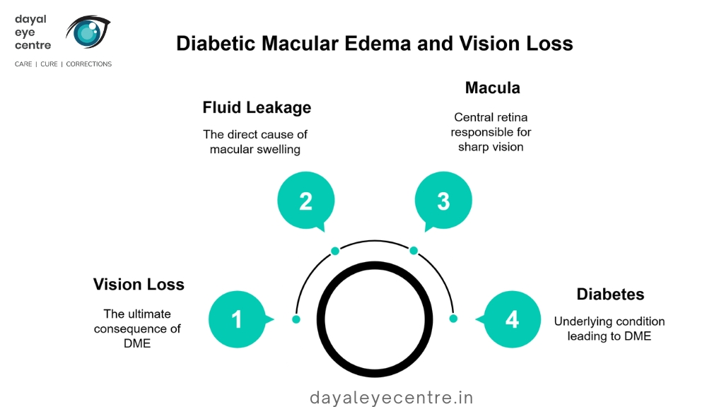 Diabetic macular edema and vision loss