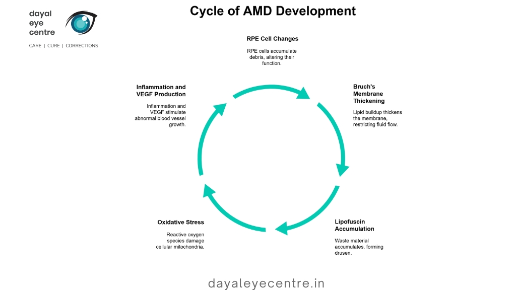 Cycle of AMD Development