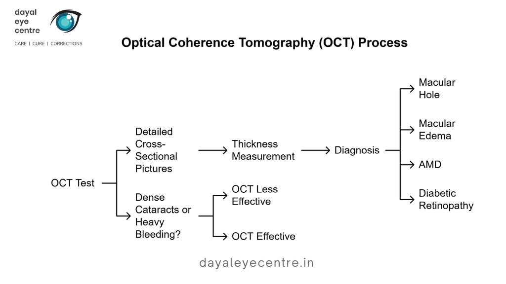 Optical coherence tomography process