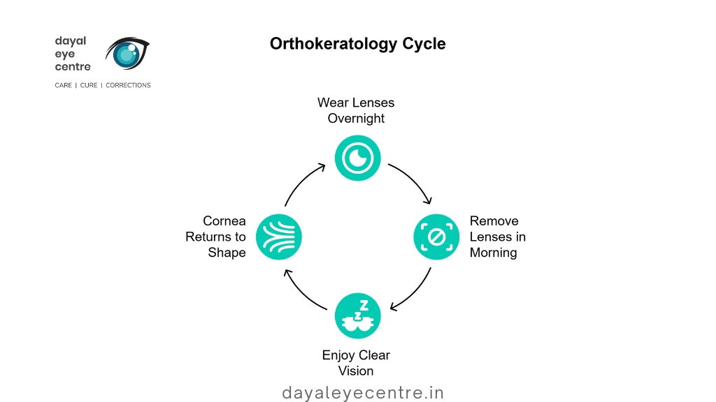 Orthokeratology Cycle