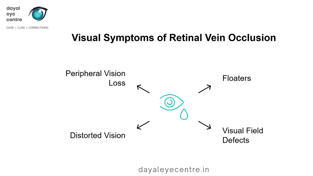 Visual symptoms of retinal vein occlusion