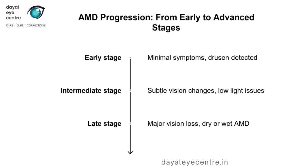 AMD progression from early to advanced stages