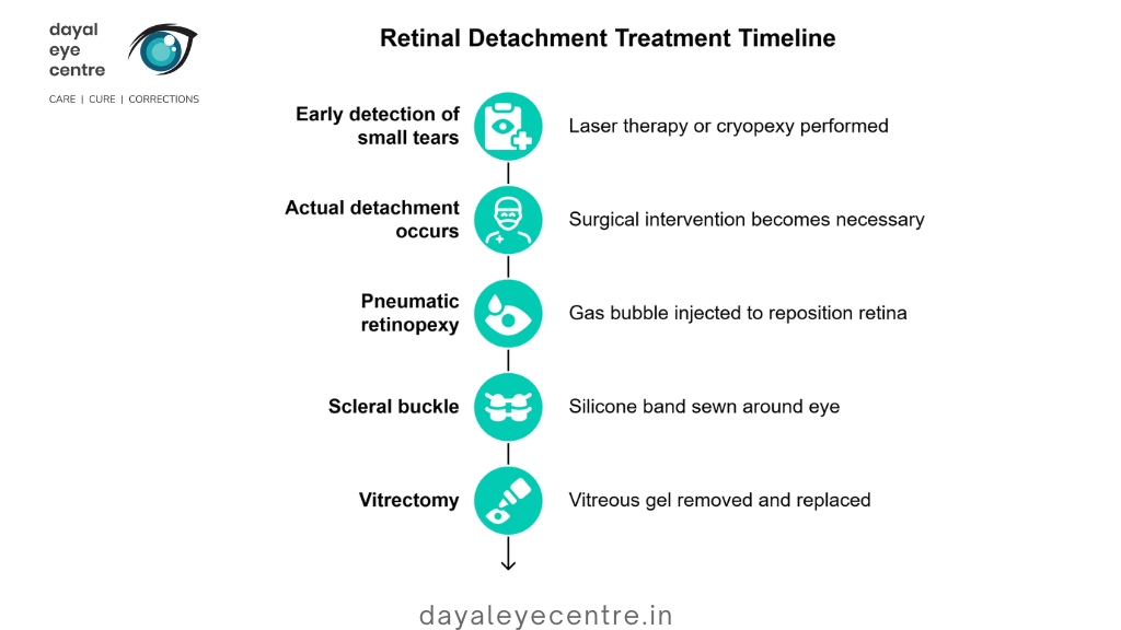 Retinal detachment treatment timeline