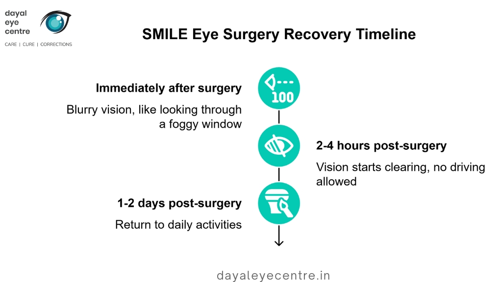 SMILE eye surgery recovery timeline