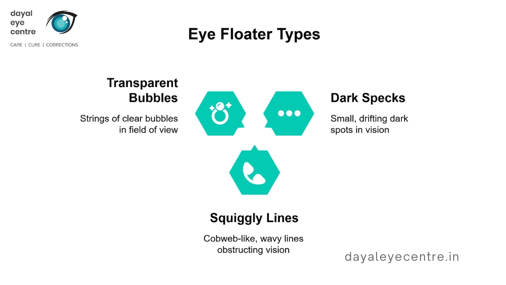 Eye floaters types