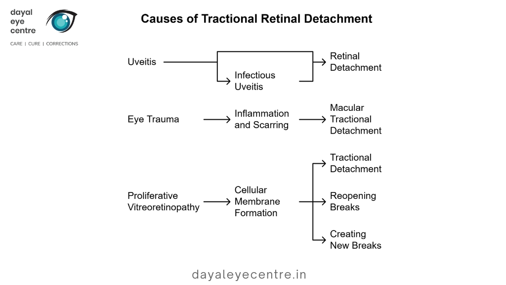 causes of tractional retinal detachment