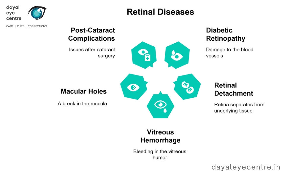 Retinal diseases
