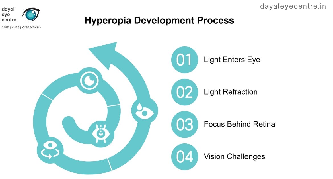 Hyperopia development process