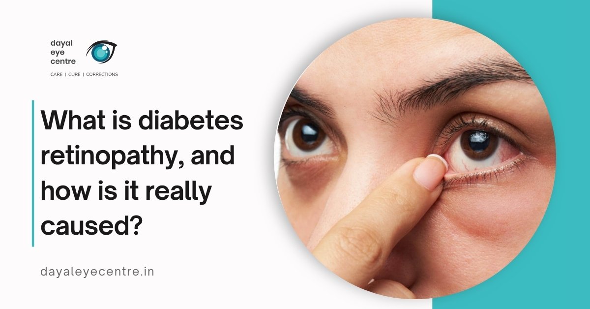What is diabetes retinopathy, and how is it really caused