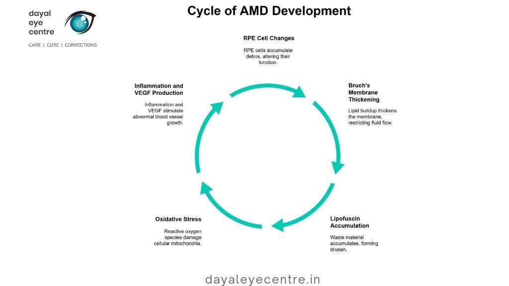 Cycle of AMD Development