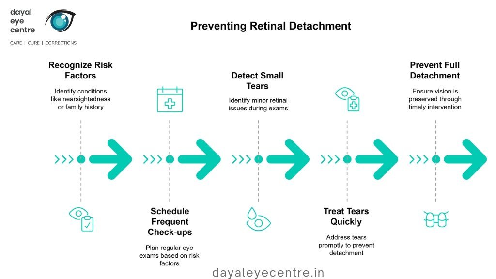 Preventing retinal detachment