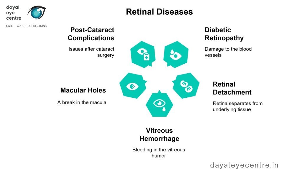 Retinal diseases