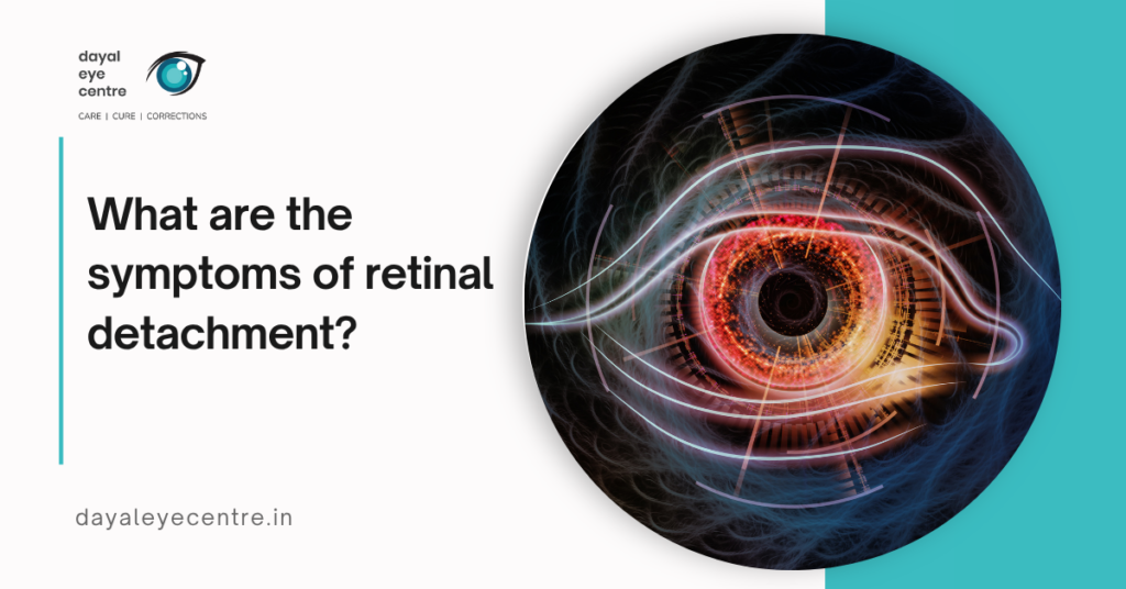 What are the symptoms of retinal detachment?
