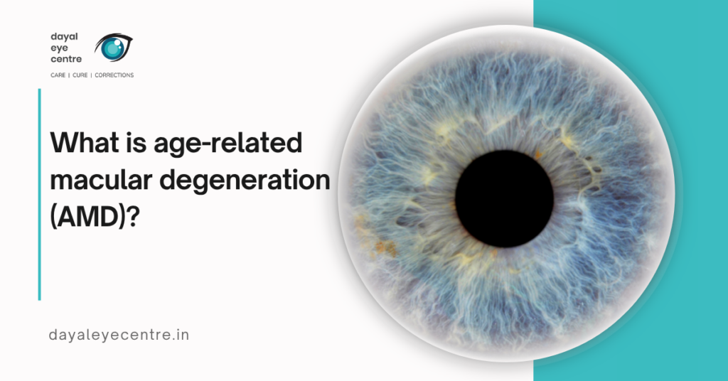 What is age-related macular degeneration (AMD)?