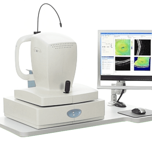 “RTVue FD-OCT – Advanced Retinal and Corneal Imaging Technology” RTVue FD-OCT device used for high-resolution retinal imaging and anterior segment analysis in eye care.